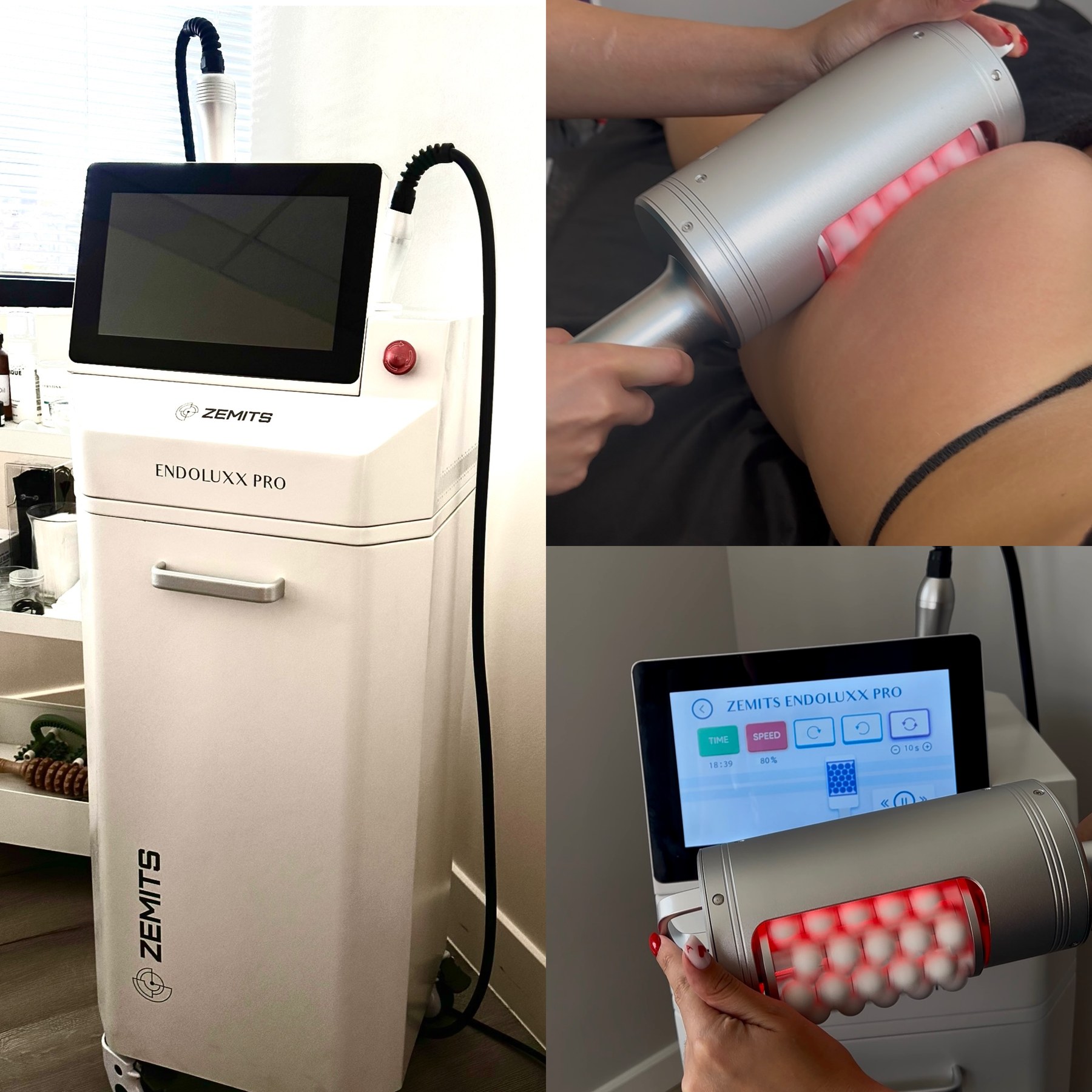 The Zemits Endoluxx Pro body-contouring device and its red-light applicator in use